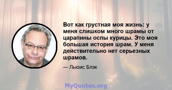 Вот как грустная моя жизнь: у меня слишком много шрамы от царапины оспы курицы. Это моя большая история шрам. У меня действительно нет серьезных шрамов.