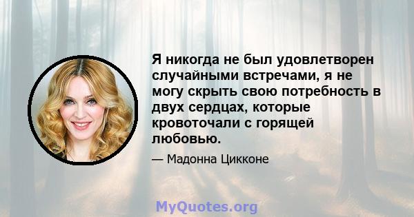 Я никогда не был удовлетворен случайными встречами, я не могу скрыть свою потребность в двух сердцах, которые кровоточали с горящей любовью.