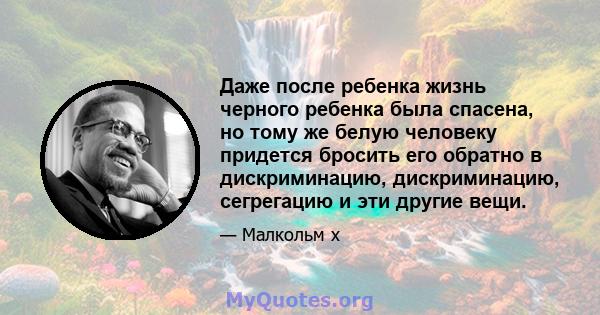 Даже после ребенка жизнь черного ребенка была спасена, но тому же белую человеку придется бросить его обратно в дискриминацию, дискриминацию, сегрегацию и эти другие вещи.