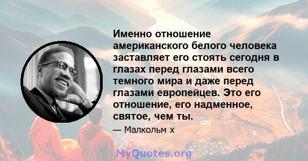 Именно отношение американского белого человека заставляет его стоять сегодня в глазах перед глазами всего темного мира и даже перед глазами европейцев. Это его отношение, его надменное, святое, чем ты.