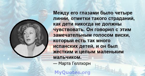 Между его глазами было четыре линии, отметки такого страданий, как дети никогда не должны чувствовать. Он говорил с этим замечательным голосом виски, который есть так много испанских детей, и он был жестким и целым