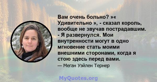 Вам очень больно? »« Удивительно », - сказал король, вообще не звучав пострадавшим. - Я развернулся. Мои внутренности могут в одно мгновение стать моими внешними сторонами, когда я стою здесь перед вами.