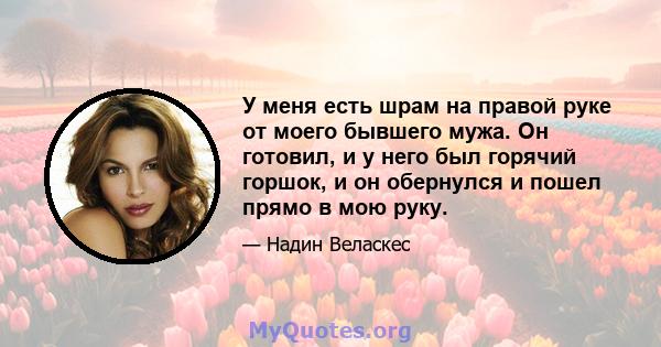 У меня есть шрам на правой руке от моего бывшего мужа. Он готовил, и у него был горячий горшок, и он обернулся и пошел прямо в мою руку.