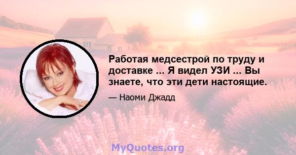 Работая медсестрой по труду и доставке ... Я видел УЗИ ... Вы знаете, что эти дети настоящие.