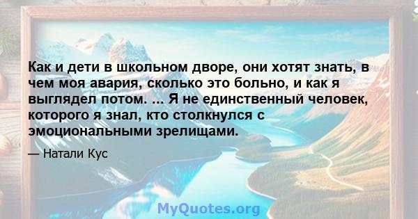 Как и дети в школьном дворе, они хотят знать, в чем моя авария, сколько это больно, и как я выглядел потом. ... Я не единственный человек, которого я знал, кто столкнулся с эмоциональными зрелищами.