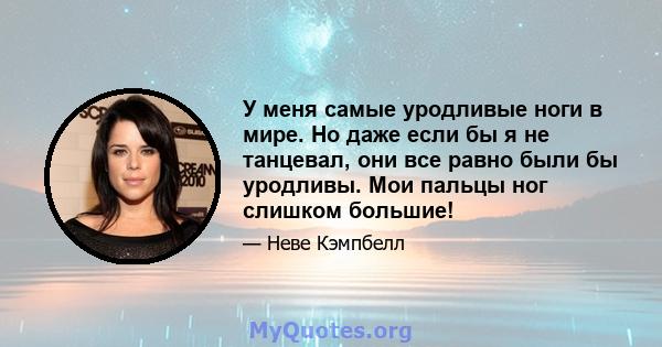 У меня самые уродливые ноги в мире. Но даже если бы я не танцевал, они все равно были бы уродливы. Мои пальцы ног слишком большие!