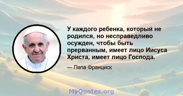 У каждого ребенка, который не родился, но несправедливо осужден, чтобы быть прерванным, имеет лицо Иисуса Христа, имеет лицо Господа.