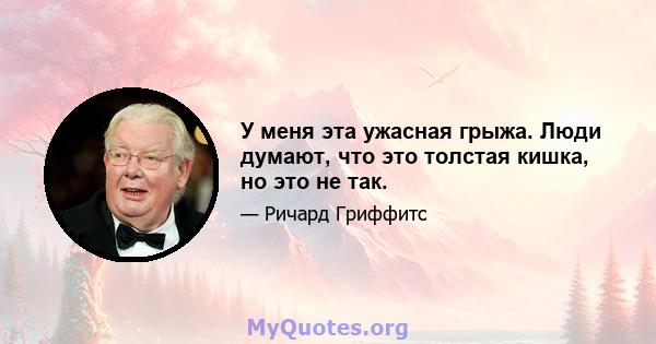 У меня эта ужасная грыжа. Люди думают, что это толстая кишка, но это не так.