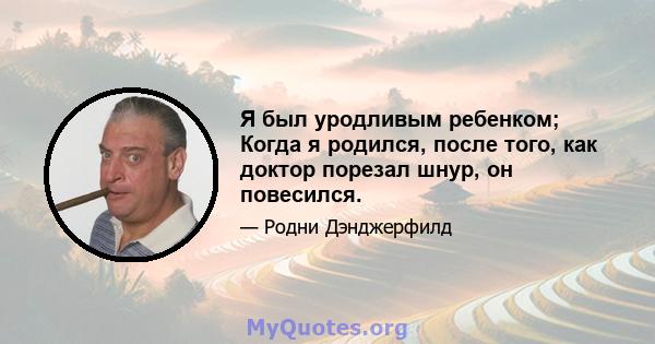 Я был уродливым ребенком; Когда я родился, после того, как доктор порезал шнур, он повесился.