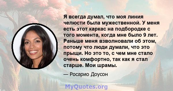 Я всегда думал, что моя линия челюсти была мужественной. У меня есть этот каркас на подбородке с того момента, когда мне было 9 лет. Раньше меня взволновали об этом, потому что люди думали, что это прыщи. Но это то, с