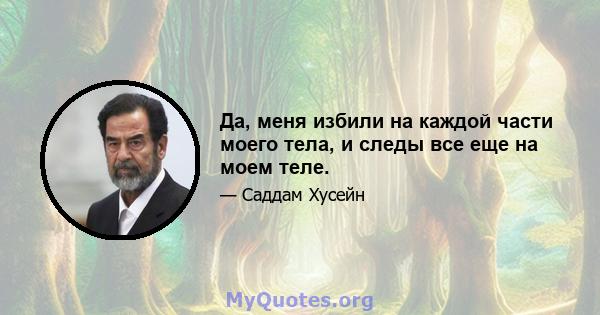 Да, меня избили на каждой части моего тела, и следы все еще на моем теле.