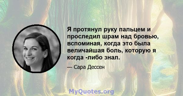 Я протянул руку пальцем и проследил шрам над бровью, вспоминая, когда это была величайшая боль, которую я когда -либо знал.