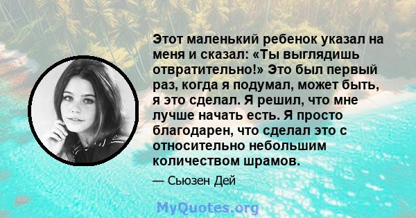 Этот маленький ребенок указал на меня и сказал: «Ты выглядишь отвратительно!» Это был первый раз, когда я подумал, может быть, я это сделал. Я решил, что мне лучше начать есть. Я просто благодарен, что сделал это с