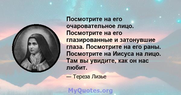 Посмотрите на его очаровательное лицо. Посмотрите на его глазированные и затонувшие глаза. Посмотрите на его раны. Посмотрите на Иисуса на лицо. Там вы увидите, как он нас любит.